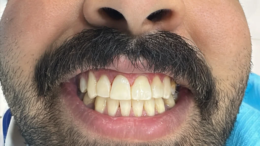 بعد
