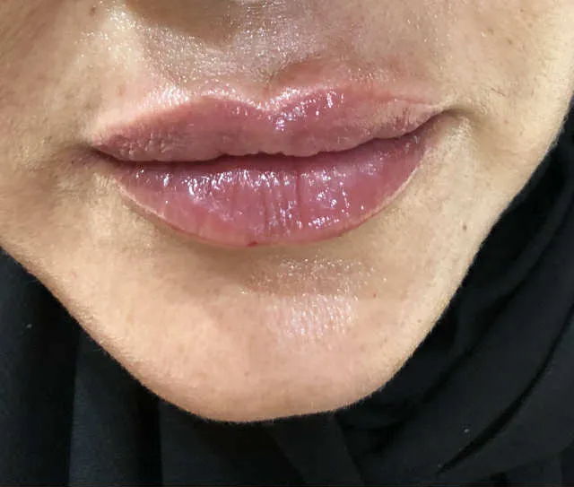 بعد