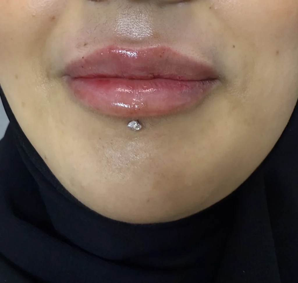بعد