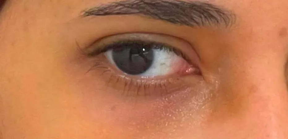 قبل