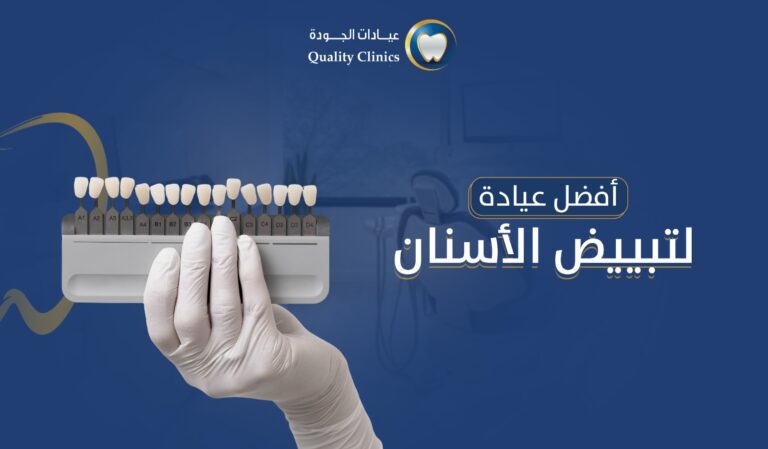 افضل عيادة لتبييض الاسنان