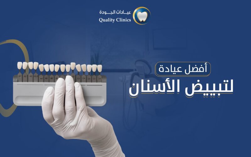 افضل عيادة لتبييض الاسنان
