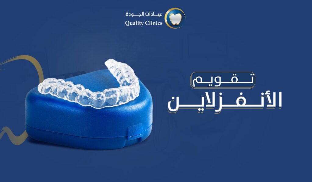 تقويم الانفزلاين