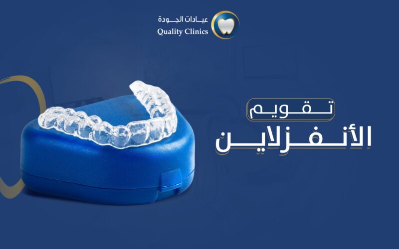 تقويم الانفزلاين