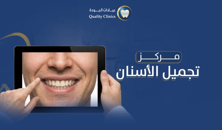 مركز تجميل الأسنان