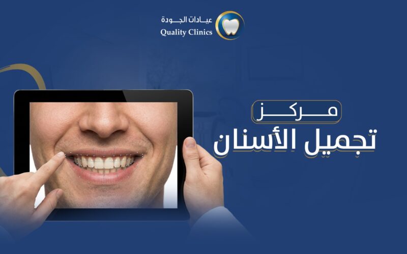 مركز تجميل الأسنان
